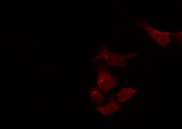 DHRS4 / PSCD Antibody - Staining HepG2 cells by IF/ICC. The samples were fixed with PFA and permeabilized in 0.1% Triton X-100, then blocked in 10% serum for 45 min at 25°C. The primary antibody was diluted at 1:200 and incubated with the sample for 1 hour at 37°C. An Alexa Fluor 594 conjugated goat anti-rabbit IgG (H+L) Ab, diluted at 1/600, was used as the secondary antibody.