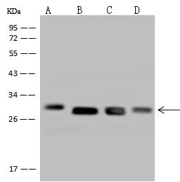 DHRS4 / PSCD Antibody - Anti-DHRS4 rabbit polyclonal antibody at 1:500 dilution. Lane A: Hela Whole Cell Lysate. Lane B: A549 Whole Cell Lysate. Lane C: MCF7 Whole Cell Lysate. Lane D: U-251 MG Whole Cell Lysate. Lysates/proteins at 30 ug per lane. Secondary: Goat Anti-Rabbit IgG (H+L)/HRP at 1/10000 dilution. Developed using the ECL technique. Performed under reducing conditions. Predicted band size: 30 kDa. Observed band size: 30 kDa.