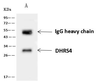 DHRS4 / PSCD Antibody - DHRS4 was immunoprecipitated using: Lane A: 0.5 mg A549 Whole Cell Lysate. 4 uL anti-DHRS4 rabbit polyclonal antibody and 60 ug of Immunomagnetic beads Protein A/G. Primary antibody: Anti-DHRS4 rabbit polyclonal antibody, at 1:100 dilution. Secondary antibody: Goat Anti-Rabbit IgG (H+L)/HRP at 1/10000 dilution. Developed using the ECL technique. Performed under reducing conditions. Predicted band size: 30 kDa. Observed band size: 30 kDa.