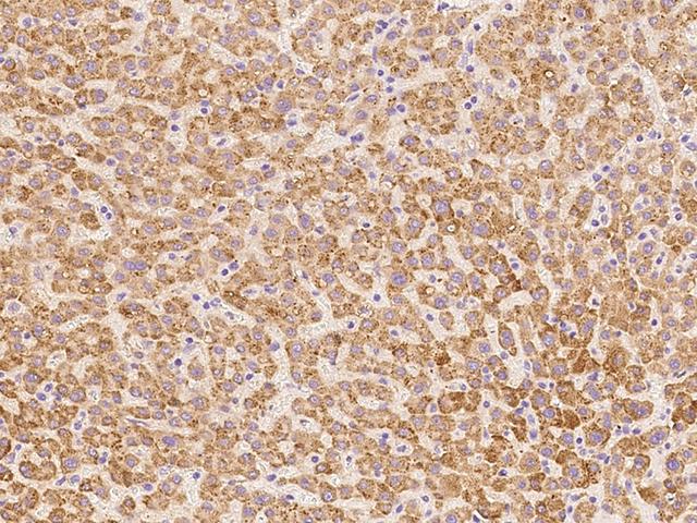 DHRS4 / PSCD Antibody - Immunochemical staining of human DHRS4 in human liver with rabbit polyclonal antibody at 1:100 dilution, formalin-fixed paraffin embedded sections.