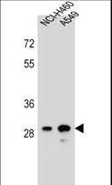 DHRS4L1 Antibody - DHRS4L1 Antibody western blot of NCI-H460,A549 cell line lysates (35 ug/lane). The DHRS4L1 antibody detected the DHRS4L1 protein (arrow).
