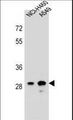 DHRS4L1 Antibody - DHRS4L1 Antibody western blot of NCI-H460,A549 cell line lysates (35 ug/lane). The DHRS4L1 antibody detected the DHRS4L1 protein (arrow).