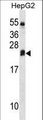 DHRS4L2 Antibody - DHRS4L2 Antibody western blot of HepG2 cell line lysates (35 ug/lane). The DHRS4L2 Antibody detected the DHRS4L2 protein (arrow).
