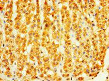DHRS7 Antibody - Immunohistochemistry of paraffin-embedded human adrenal gland using antibody at 1:100 dilution.  This image was taken for the unconjugated form of this product. Other forms have not been tested.