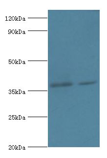 DHRS7 Antibody - Western blot. All lanes: Dehydrogenase/reductase SDR family member 7 antibody at 2 ug/ml Lane 1:HepG2 whole cell lysate. Lane 2: MCF-7 whole cell lysate. Secondary antibody: Goat polyclonal to rabbit at 1:10000 dilution.  This image was taken for the unconjugated form of this product. Other forms have not been tested.