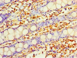 DHRS7 Antibody - Immunohistochemistry of paraffin-embedded human rectum tissue using antibody at 1:100 dilution.  This image was taken for the unconjugated form of this product. Other forms have not been tested.