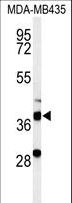 DHRS7 Antibody - Western blot of DHRS7 Antibody in MDA-MB435 cell line lysates (35 ug/lane). DHRS7 (arrow) was detected using the purified antibody.