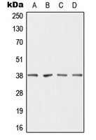 DHRS7 Antibody - Western blot analysis of DHRS7 expression in MCF7 (A); HepG2 (B); mouse liver (C); rat liver (D) whole cell lysates.