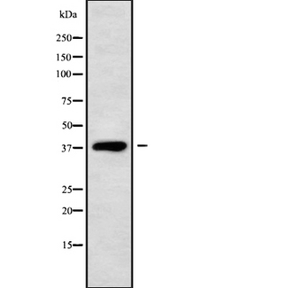 DHRS7 Antibody - Western blot analysis of DHRS7 using Jurkat whole cells lysates
