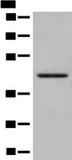 DHRS7 Antibody - Western blot analysis of Human kidney tissue lysate  using DHRS7 Polyclonal Antibody at dilution of 1:400