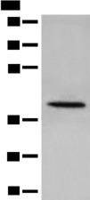 DHRS7 Antibody - Western blot analysis of 231 cell lysate  using DHRS7 Polyclonal Antibody at dilution of 1:400