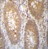 DHRS7B Antibody - DHRS7B Antibody immunohistochemistry of formalin-fixed and paraffin-embedded human colon tissue followed by peroxidase-conjugated secondary antibody and DAB staining.