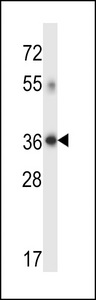 DHRS7C Antibody - DHRS7C Antibody western blot of human placenta tissue lysates (35 ug/lane). The DHRS7C antibody detected the DHRS7C protein (arrow).