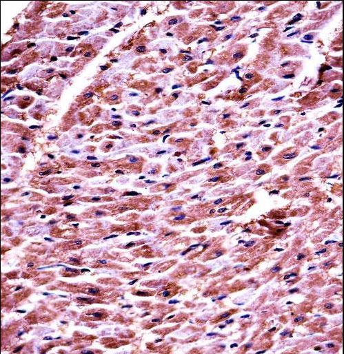 DHRS7C Antibody - DHRS7C Antibody immunohistochemistry of formalin-fixed and paraffin-embedded human heart tissue followed by peroxidase-conjugated secondary antibody and DAB staining.