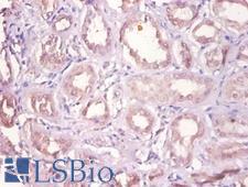 DHRS9 Antibody - Immunohistochemistry of paraffin-embedded human kidney using DHRS9 antibody at dilution of 1:100.  This image was taken for the unconjugated form of this product. Other forms have not been tested.