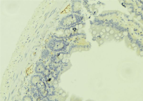 DHRS9 Antibody - 1:100 staining mouse colon tissue by IHC-P. The sample was formaldehyde fixed and a heat mediated antigen retrieval step in citrate buffer was performed. The sample was then blocked and incubated with the antibody for 1.5 hours at 22°C. An HRP conjugated goat anti-rabbit antibody was used as the secondary.