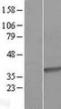 DHRS9 Protein - Western validation with an anti-DDK antibody * L: Control HEK293 lysate R: Over-expression lysate