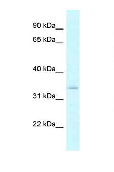 DHRSX Antibody - DHRSX antibody Western blot of 1 Cell lysate. Antibody concentration 1 ug/ml.  This image was taken for the unconjugated form of this product. Other forms have not been tested.