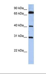 DHRSX Antibody - Hela cell lysate. Antibody concentration: 1.0 ug/ml. Gel concentration: 12%.  This image was taken for the unconjugated form of this product. Other forms have not been tested.