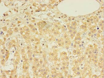 DHRSX Antibody - Immunohistochemistry of paraffin-embedded human adrenal gland tissue using antibody at 1:100 dilution.