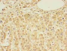 DHRSX Antibody - Immunohistochemistry of paraffin-embedded human adrenal gland tissue using antibody at 1:100 dilution.