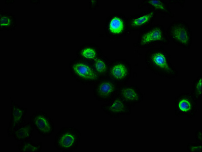 DHRSX Antibody - Immunofluorescence staining of A549 cells with DHRSX Antibody at 1:100, counter-stained with DAPI. The cells were fixed in 4% formaldehyde, permeabilized using 0.2% Triton X-100 and blocked in 10% normal Goat Serum. The cells were then incubated with the antibody overnight at 4°C. The secondary antibody was Alexa Fluor 488-congugated AffiniPure Goat Anti-Rabbit IgG(H+L).