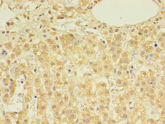 DHRSX Antibody - Immunohistochemistry of paraffin-embedded human adrenal gland tissue using DHRSX Antibody at dilution of 1:100