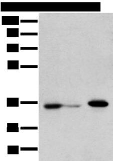 DHRSX Antibody - Western blot analysis of HepG2 cell Hela cell and A549 cell  using DHRSX Polyclonal Antibody at dilution of 1:350