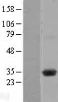 DHRSX Protein - Western validation with an anti-DDK antibody * L: Control HEK293 lysate R: Over-expression lysate