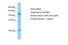 DHTKD1 Antibody -  This image was taken for the unconjugated form of this product. Other forms have not been tested.