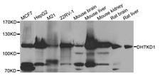 DHTKD1 Antibody - Western blot analysis of extracts of various cell lines.