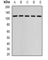 DHTKD1 Antibody - Western blot analysis of DHTKD1 expression in MCF7 (A); HepG2 (B); mouse brain (C); mouse kidney (D); rat liver (E) whole cell lysates.