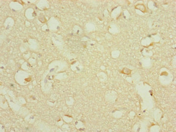 DHTKD1 Antibody - Immunohistochemistry of paraffin-embedded human brain tissue at dilution of 1:100