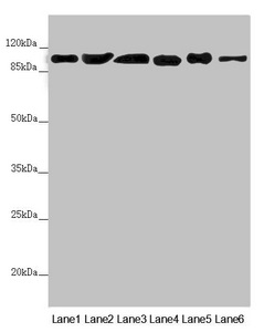 DHTKD1 Antibody - Western blot All Lanes:DHTKD1 antibody at 1.82 ug/ml Lane 1: Mouse heart tissue Lane 2: Mouse liver tissue Lane 3: Mouse kidney tissue Lane 4: A431 whole cell lysate Lane 5: MCF7 whole cell lysate Lane 6: HepG-2 whole cell lysate Secondary Goat polyclonal to rabbit IgG at 1/10000 dilution Predicted band size: 103 kDa Observed band size: 103 kDa