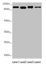 DHTKD1 Antibody - Western blot All lanes: DHTKD1 antibody at 1.82µg/ml Lane 1: Mouse heart tissue Lane 2: A431 whole cell lysate Lane 3: MCF-7 whole cell lysate Lane 4: HepG2 whole cell lysate Secondary Goat polyclonal to rabbit IgG at 1/10000 dilution Predicted band size: 103 kDa Observed band size: 103 kDa