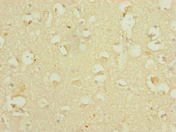 DHTKD1 Antibody - Immunohistochemistry of paraffin-embedded human brain tissue at dilution of 1:100