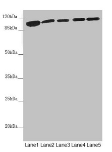 DHTKD1 Antibody - Western blot All Lanes:DHTKD1 antibody at 1.81 ug/ml Lane 1: Mouse liver tissue Lane 2: Mouse kidney tissue Lane 3: A431 whole cell lysate Lane 4: MCF7 whole cell lysate Lane 5: HepG-2 whole cell lysate Secondary Goat polyclonal to rabbit IgG at 1/10000 dilution Predicted band size: 103 kDa Observed band size: 103 kDa