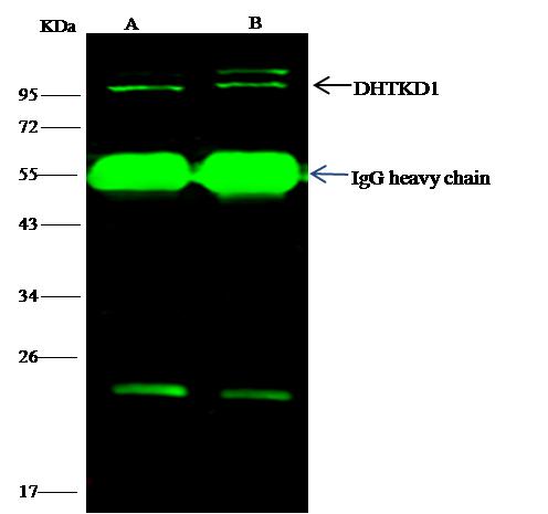 DHTKD1 Antibody - DHTKD1 was immunoprecipitated using: Lane A: 0.5 mg Hela Whole Cell Lysate. Lane B: 0.5 mg A549 Whole Cell Lysate. 4 uL anti-DHTKD1 rabbit polyclonal antibody and 15 ul of 50% Protein G agarose. Primary antibody: Anti-DHTKD1 rabbit polyclonal antibody, at 1:100 dilution. Secondary antibody: Dylight 800-labeled antibody to rabbit IgG (H+L), at 1:5000 dilution. Developed using the odssey technique. Performed under reducing conditions. Predicted band size: 101 kDa. Observed band size: 101 kDa.