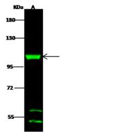 DHTKD1 Antibody - Anti-DHTKD1 rabbit polyclonal antibody at 1:500 dilution. Lane A: A431 Whole Cell Lysate. Lysates/proteins at 30 ug per lane. Secondary: Goat Anti-Rabbit IgG H&L (Dylight 800) at 1/10000 dilution. Developed using the Odyssey technique. Performed under reducing conditions. Predicted band size: 103 kDa. Observed band size: 105 kDa.
