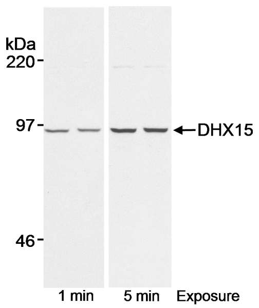 DHX15 Antibody - Detection of Human DHX 15 by Western Blot. Samples: Whole cell lysate (55 ug/lane) from normal human lymphoblasts. Antibody: Affinity purified rabbit anti-DHX15 antibody used at 0.1 ug/ml. Detection: Chemiluminescence with exposure times of 1 and 5 minutes.