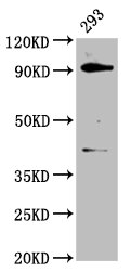DHX15 Antibody - Positive Western Blot detected in 293 whole cell lysate. All lanes: DHX15 antibody at 3.7 µg/ml Secondary Goat polyclonal to rabbit IgG at 1/50000 dilution. Predicted band size: 91 KDa. Observed band size: 91 KDa