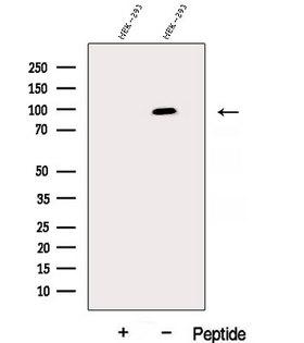 DHX15 Antibody - Western blot analysis of extracts of HEK293 cells using DHX15 antibody. The lane on the left was treated with blocking peptide.