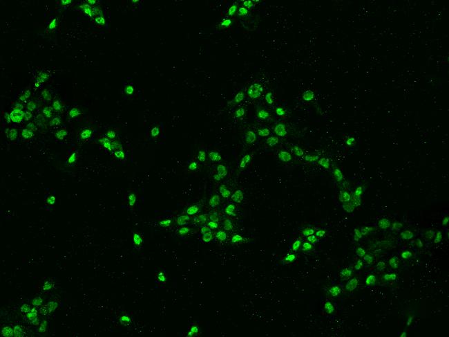 DHX15 Antibody - Immunofluorescence staining of DHX15 in A431 cells. Cells were fixed with 4% PFA, permeabilzed with 0.1% Triton X-100 in PBS, blocked with 10% serum, and incubated with rabbit anti-Human DHX15 polyclonal antibody (dilution ratio 1:200) at 4°C overnight. Then cells were stained with the Alexa Fluor 488-conjugated Goat Anti-rabbit IgG secondary antibody (green). Positive staining was localized to Nucleus.