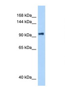 DHX16 / DBP2 Antibody - DHX16 antibody Western blot of PANC1 Cell lysate. Antibody concentration 1 ug/ml.  This image was taken for the unconjugated form of this product. Other forms have not been tested.