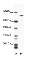 DHX16 / DBP2 Antibody - A: Marker, B: Jurkat Cell Lysate.  This image was taken for the unconjugated form of this product. Other forms have not been tested.