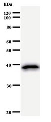 DHX29 Antibody - Western blot of immunized recombinant protein using DHX29 antibody.