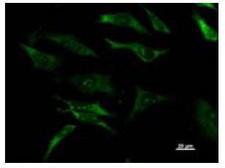 DHX29 Antibody - Immunofluorescent staining using DHX29 antibody. Immunostaining analysis in HeLa cells. HeLa cells were fixed with 4% paraformaldehyde and permeabilized with 0.01% Triton-X100 in PBS. The cells were immunostained with anti-DHX29 antibody.