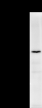 DHX29 Antibody - Detection of human DHX29 by Western blot. Samples: Whole cell lysate (25 ug) from HeLa cells. Predicted molecular weight: 155 kDa