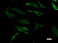DHX29 Antibody - Immunostaining analysis in HeLa cells. HeLa cells were fixed with 4% paraformaldehyde and permeabilized with 0.1% Triton X-100 in PBS. The cells were immunostained with anti-DHX29 mAb.