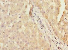 DHX30 Antibody - Immunohistochemistry of paraffin-embedded human liver tissue using antibody at dilution of 1:100.